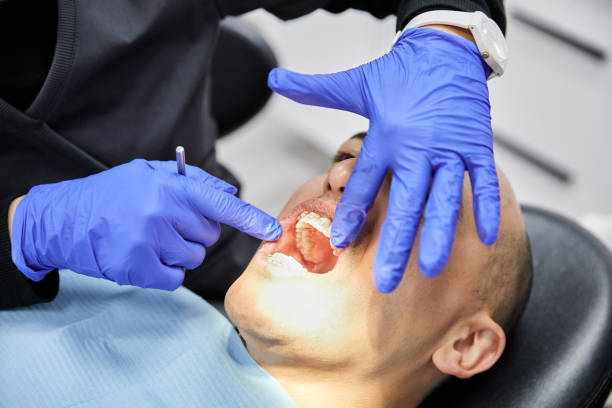 Best Broken or Cracked Tooth Emergency Dentist in The Woodlands, TX