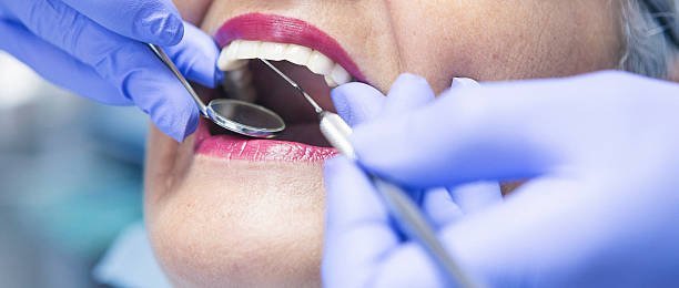 Best Urgent Dental Care for Toothache in The Woodlands, TX